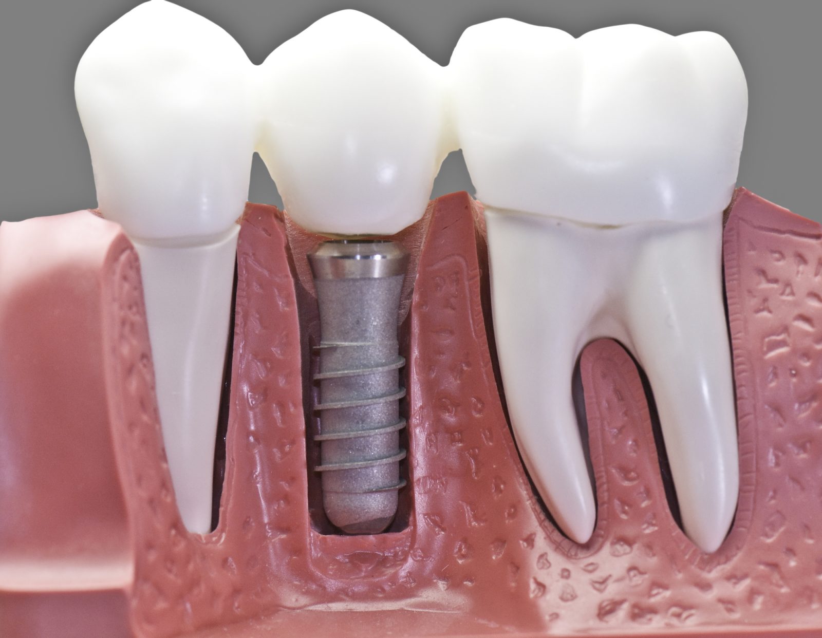 Centre médical dentaire : quels sont les risques des problèmes dentaires ?